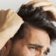 A dermatite seborreica do couro cabeludo, conhecida popularmente como caspa, é uma inflamação que causa descamação, vermelhidão e coceira no couro cabeludo.